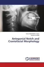 Antegonial Notch and Craniofacial Morphology - Yassir Yassir Abdulkadhim