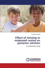 Effect of Missing or Malposed Canine on Posterior Attrition - Ruchika Mishra