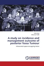 A study on incidence and management outcome of posterior fossa Tumour - Sofia Noor