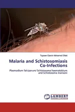 Malaria and Schistosomiasis Co-Infections - Tayseer Elamin Mohamed Elfaki