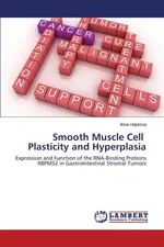 Smooth Muscle Cell Plasticity and Hyperplasia - Ilona Hapkova