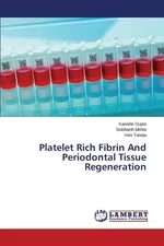 Platelet Rich Fibrin And Periodontal Tissue Regeneration - Kanishk Gupta