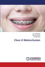 Class II Malocclusion - Bhat Jan Mohd