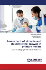 Assessment of zirconia and stainless steel crowns in primary molars - Mohamed Wakwak