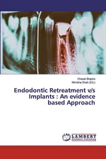 Endodontic Retreatment v/s Implants - Dhaval Bhadra