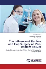 The Influence of Flapless and Flap Surgery on Peri-implant Tissues - Alaa Mansour