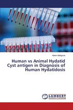 Human vs Animal Hydatid Cyst antigen in Diagnosis of Human Hydatidosis - Abeer Mahgoub