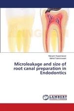 Microleakage and size of root canal preparation in Endodontics - Maryam Kazemipoor
