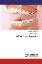 White Spot Lesions - Medha Lakhanam