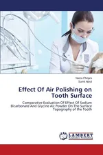 Effect Of Air Polishing on Tooth Surface - Nazia Chopra