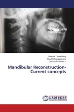 Mandibular Reconstruction- Current Concepts - Shouvik Chowdhury