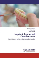 Implant Supported Overdentures - Paramba Acharya