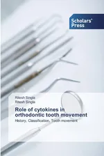 Role of cytokines in orthodontic tooth movement - Ritesh Singla