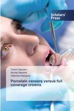 Porcelain veneers versus full coverage crowns - Yosra Gassara