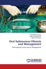 Oral Submucous Fibrosis and Management - Kanwaldeep Soodan