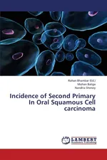 Incidence of Second Primary in Oral Squamous Cell Carcinoma - Mohan Baliga