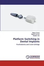 Platform Switching in Dental Implants - Megha Chopra