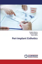 Peri-implant Esthetics - Pratibha Sharma