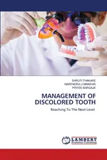 MANAGEMENT OF DISCOLORED TOOTH - SHRUTI THAKARE
