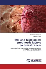 MRI and histological prognostic factors in breast cancer - Domiziana Santucci
