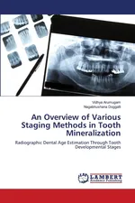 An Overview of Various Staging Methods in Tooth Mineralization - VIDHYA ARUMUGAM
