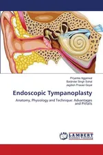 Endoscopic Tympanoplasty - Priyanka Aggarwal