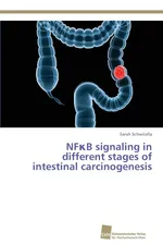 NF?B signaling in different stages of intestinal carcinogenesis - Sarah Schwitalla