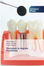 Occlusion In Implant Prosthesis - Vishal Rathod