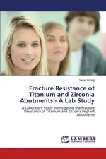 Fracture Resistance of Titanium and Zirconia Abutments - A Lab Study - Jamie Foong