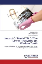 Impact of Mesial Tilt of the Lower First Molar on Wisdom Tooth - Shaalan Araim