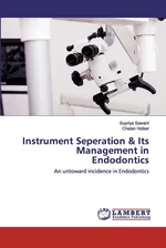 Instrument Seperation & Its Management in Endodontics - Supriya Sawant