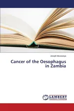 Cancer of the Oesophagus in Zambia - Joseph Musowoya