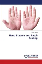 Hand Eczema and Patch Testing - Mrinal Gupta
