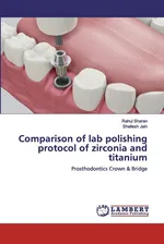 Comparison of lab polishing protocol of zirconia and titanium - Rahul Sharan