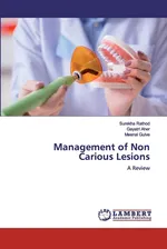 Management of Non Carious Lesions - Surekha Rathod