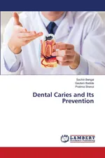 Dental Caries and Its Prevention - Sachin Bengal