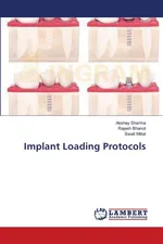 Implant Loading Protocols - Akshey Sharma