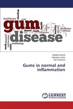 Gums in normal and inflammation - Nataliya Gasiuk