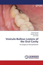 Vesiculo-Bullous Lesions of the Oral Cavity - Fahad Samadi