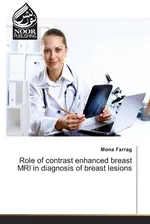 Role of contrast enhanced breast MRI in diagnosis of breast lesions - Mona Farrag