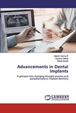 Advancements in Dental Implants - R Adarsh Varma