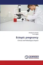 Ectopic pregnancy - Dhirajkumar Shukla