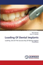 Loading Of Dental Implants - Nitai Debnath