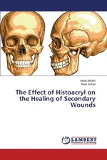 The Effect of Histoacryl on the Healing of Secondary Wounds - Huda Akram