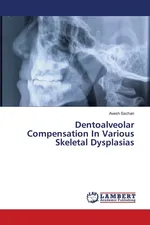 Dentoalveolar Compensation In Various Skeletal Dysplasias - Avesh Sachan