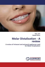 Molar Distalization - A review - Rinju John