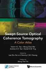 SWEPT-SOURCE OPTICAL COHERENCE TOMOGRAPHY - Kelvin Y C Teo