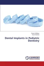 Dental Implants in Pediatric Dentistry - Fawaz Siddiqui