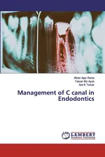 Management of C canal in Endodontics - Afnan Ajaz Raina