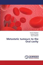 Metastatic tumours to the Oral cavity - Arvind Venkatesh